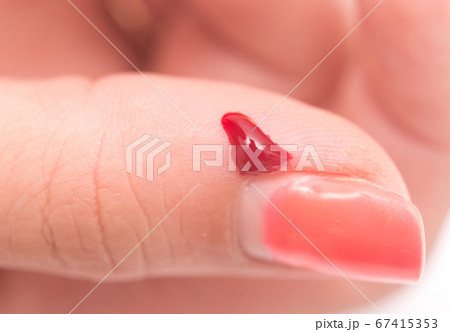 blood on finger 67415353