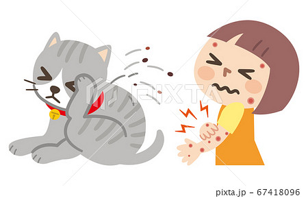 ノミで痒くて体をかきむしる猫と虫に刺された女の子 67418096