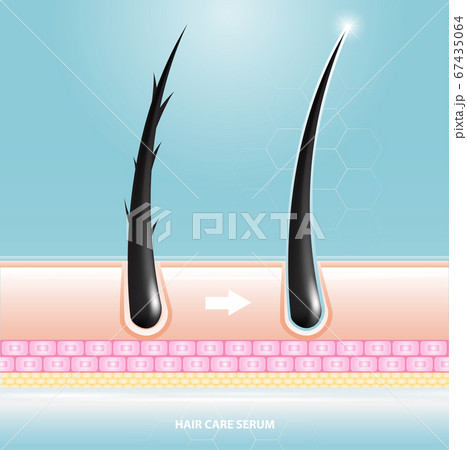 Hair care serum follicle diagnostics. Anatomy skin, medical human, epidermis layer, vector illustration design. Hair care serum follicle diagnostics. Anatomy skin, medical human, epidermis layer, vector illustration design. 67435064