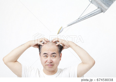 育毛マッサージをする中年男性 67458038