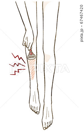 ムダ毛処理で肌荒れする女性の脚のイラスト素材
