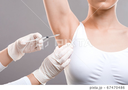 Woman receiving underarm treatment against hyperhidrosis, closeup 67470486