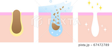 洗顔　毛穴　ビフォアアフター 67472789