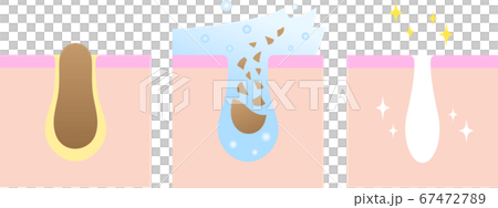 洗顔　毛穴　ビフォアアフター 67472789