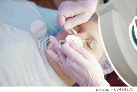 Procedure mechanical face cleaning in beauty salon.  67484270