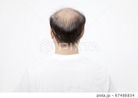薄毛男性の後ろ姿 67486834