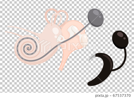 人工内耳の装置と蝸牛のイラストのイラスト素材 [67537370] - PIXTA