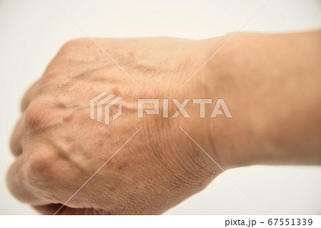 初老男性のシミのある右手甲5 67551339