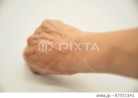 初老男性のシミのある右手甲3 初老男性のシミのある右手甲3 67551341