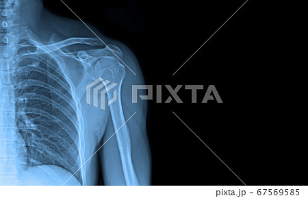X-ray image X-ray image 67569585