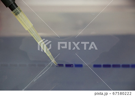 Polymerase Chain Reaction (PCR) and Agarose gel electrophoresis is a method of gel electrophoresis used in biochemistry, molecular biology, genetics, and clinical chemistry in lab. 67580222