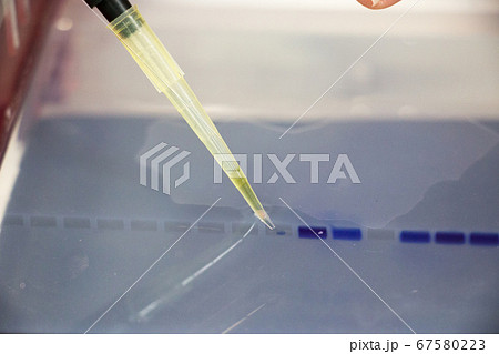 Polymerase Chain Reaction (PCR) and Agarose gel electrophoresis is a method of gel electrophoresis used in biochemistry, molecular biology, genetics, and clinical chemistry in lab. Polymerase Chain Reaction (PCR) and Agarose gel electrophoresis is a method of gel electrophoresis used in biochemistry, molecular biology, genetics, and clinical chemistry in lab. 67580223
