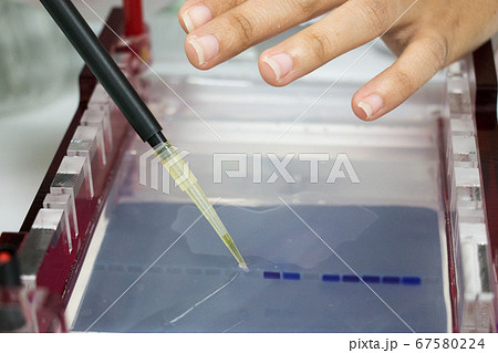 Polymerase Chain Reaction (PCR) and Agarose gel electrophoresis is a method of gel electrophoresis used in biochemistry, molecular biology, genetics, and clinical chemistry in lab. Polymerase Chain Reaction (PCR) and Agarose gel electrophoresis is a method of gel electrophoresis used in biochemistry, molecular biology, genetics, and clinical chemistry in lab. 67580224