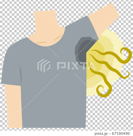 Men who suffer from armpit sweat, armpit odor, body odor Men who suffer from armpit sweat, armpit odor, body odor 67580490
