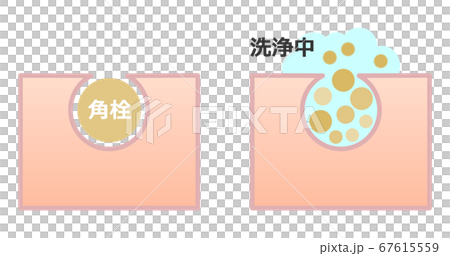 清潔方形插頭以使您的皮膚看起來漂亮的插圖 67615559