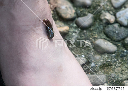 Closeup on leech attach biting on leg in tropical forest 67687745