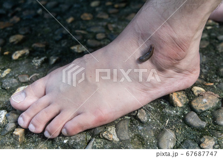 Leech attach biting on leg in tropical forest 67687747