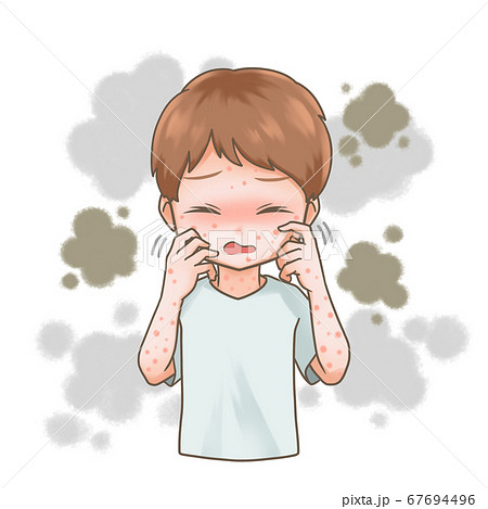 顔を掻く男性のイラスト 67694496