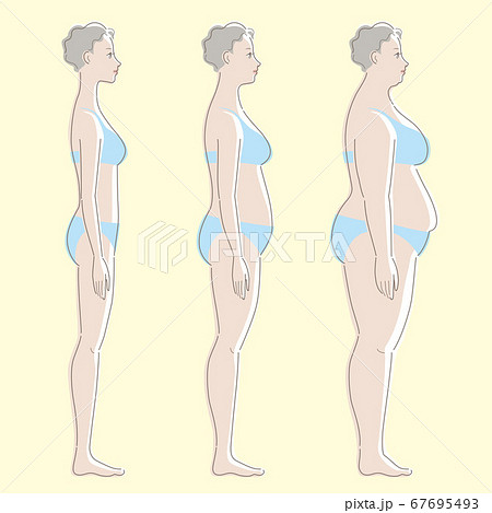 Upper Body Woman Suffers Skin Disease Stock Vector (Royalty Free)  1498839584
