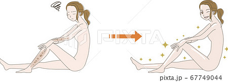 シミが気になる 女性 の イラスト　ビフォー アフター 67749044