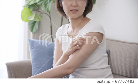 腕を掻いている若い女性	 67767482