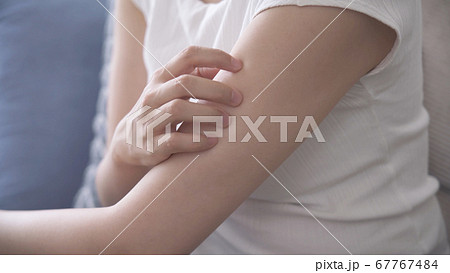 腕を掻いている若い女性	 67767484