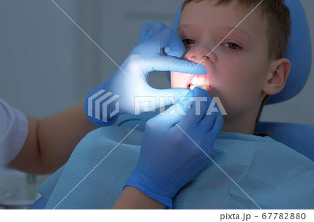 Doctor dentist hygienist applying fluoride to teen boy teeth with brush. 67782880