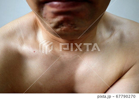 節食成功的日本男人的鎖骨 照片素材 圖片 圖庫