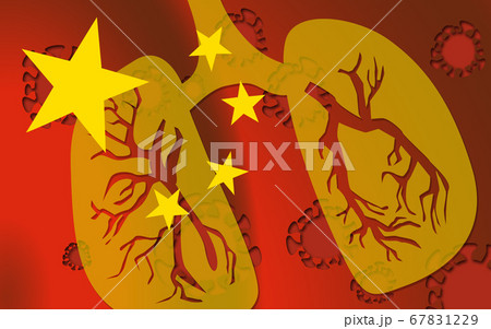 Wuhan coronavirus 2019-nCoV concept 67831229