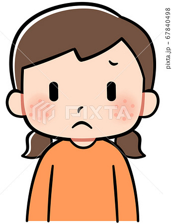 顔に湿疹が出ている女の子のイラスト素材