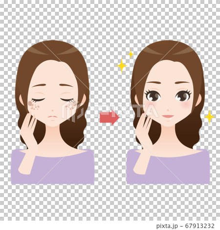 Comparative illustration of a woman suffering from spots and dull skin 67913232