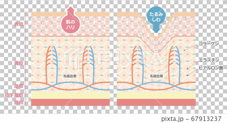 正常な肌としわのある肌を比較した肌の断面図 イラストのイラスト素材