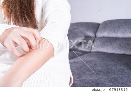 Young woman scratching his arm while sitting on 67913316