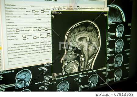 brain image on screen computer 67913958
