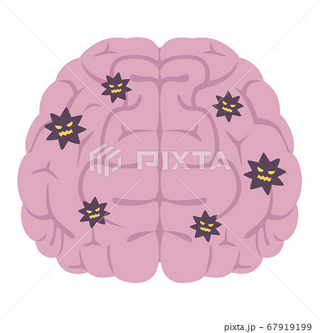 ウィルスが侵入した脳のイラスト。 67919199