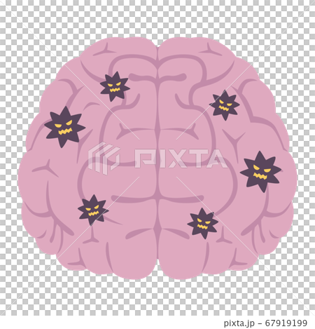 病毒入侵的大腦的插圖。 病毒入侵的大腦的插圖。 67919199