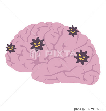 ウィルスが侵入した脳のイラスト。 67919200