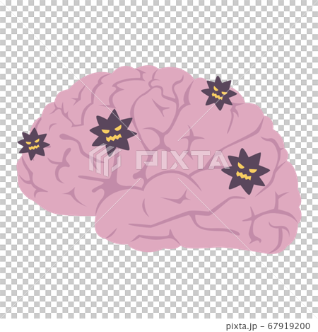 ウィルスが侵入した脳のイラスト。 67919200