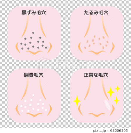 Nose pore pattern 68006305