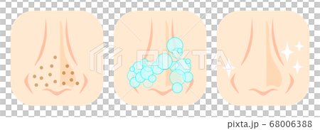 洗鼻孔的插圖 68006388