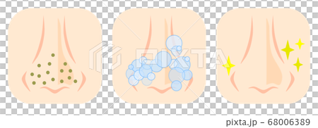 洗鼻孔的插圖 68006389