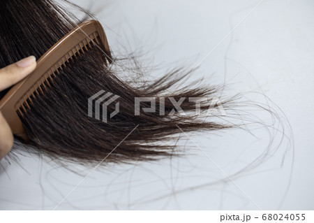 Problem of Young woman hair loss, with thin hair. Problem of Young woman hair loss, with thin hair. 68024055
