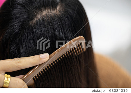 Problem of Young woman hair loss, with thin hair. Problem of Young woman hair loss, with thin hair. 68024056
