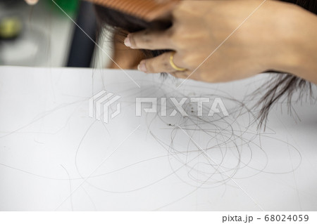 Problem of Young woman hair loss, with thin hair. Problem of Young woman hair loss, with thin hair. 68024059