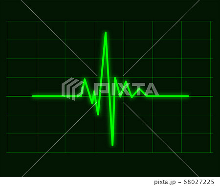 Green cardiac waveforms of heart cardiogram Green cardiac waveforms of heart cardiogram 68027225