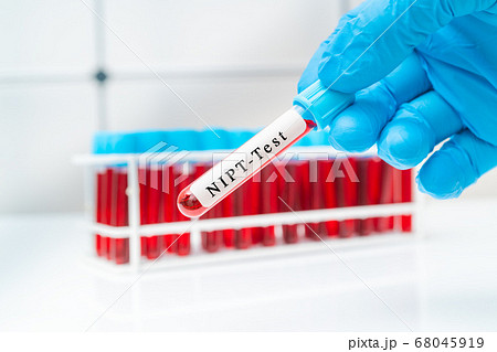Blood sample   test tube in doctor hand for   NIPT 68045919