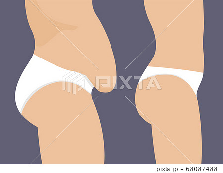Female belly fat loss plastic surgery. Abdomen fatty girl abs lose before and after cellulite Female belly fat loss plastic surgery. Abdomen fatty girl abs lose before and after cellulite 68087488