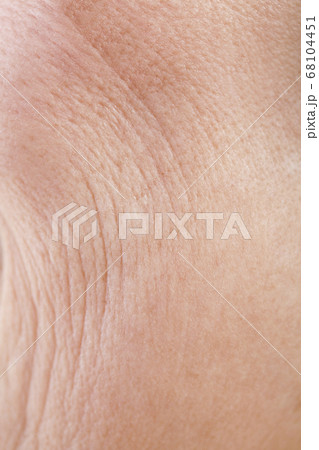 シニア女性の肌 シニア女性の肌 68104451