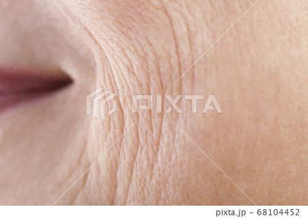 シニア女性の肌 68104452