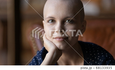 Portrait of young hairless woman sick with cancer 68133935